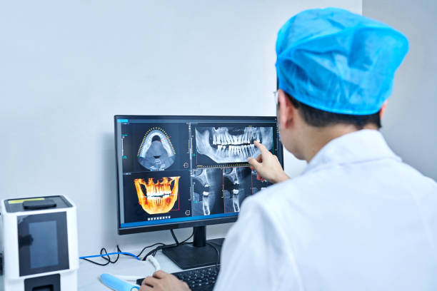 Urgent Tooth Repair in LA