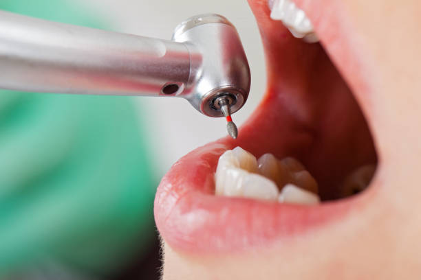 Best Emergency Dentist Open Today  in Inniswold, LA